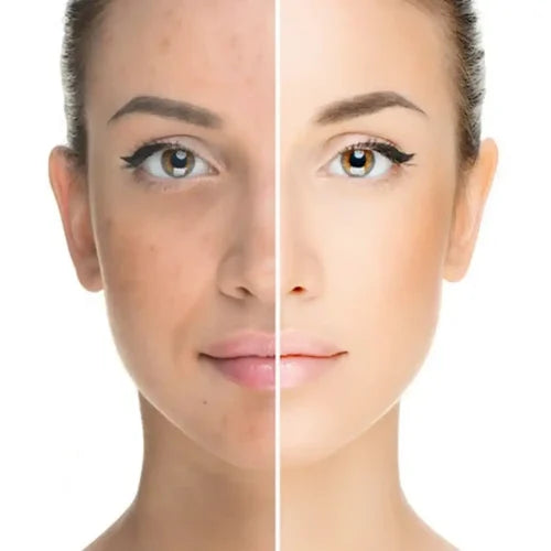 Skin Booster & Polynucleotide Course